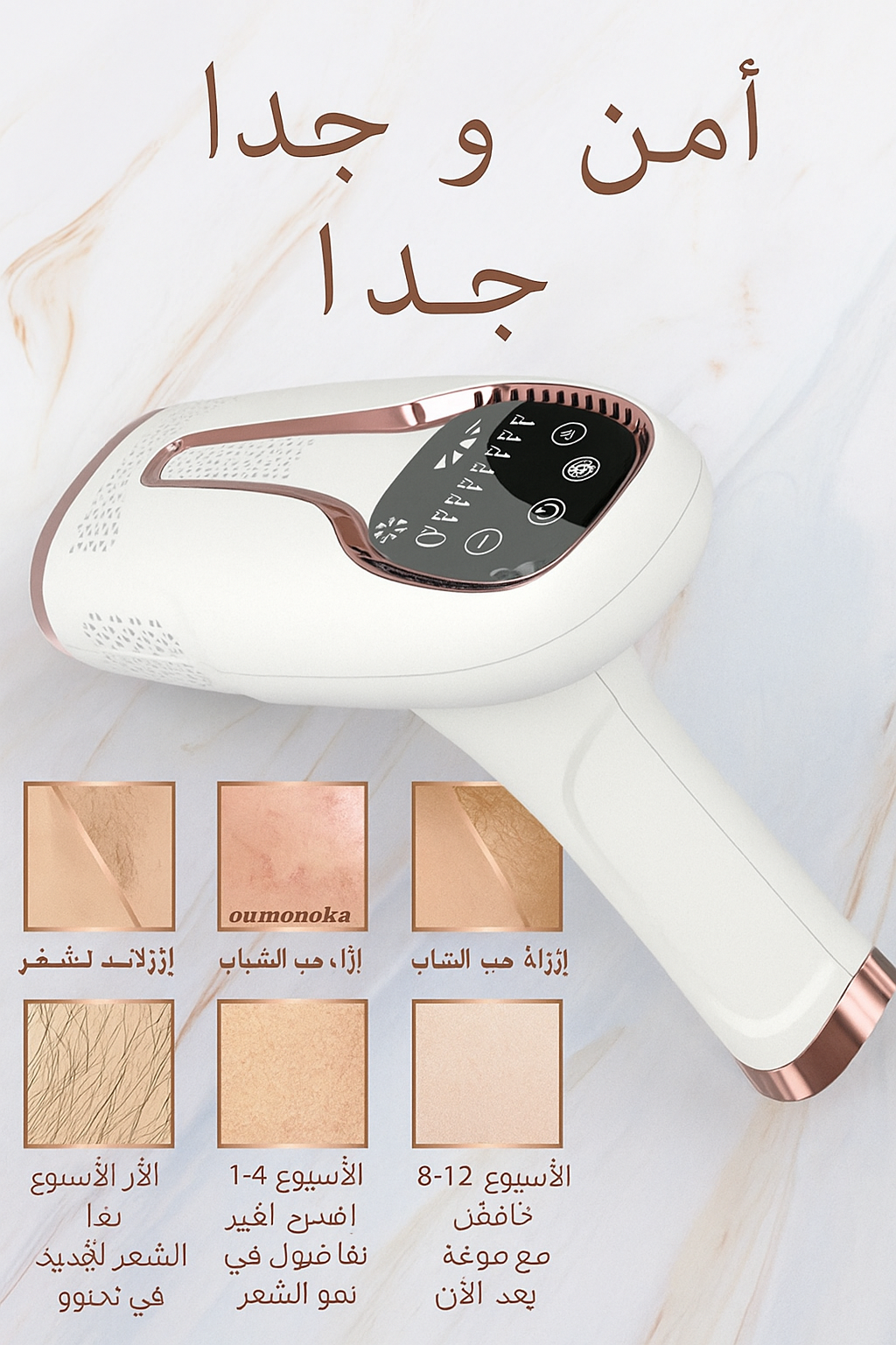 جهاز إزالة الشعر بالليزر IPL مع تبريد بالثلج