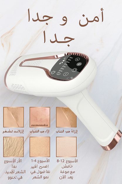 جهاز إزالة الشعر بالليزر IPL مع تبريد بالثلج