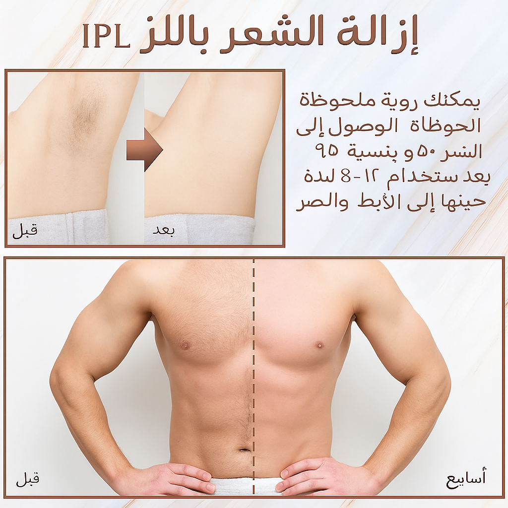 جهاز إزالة الشعر بالليزر IPL مع تبريد بالثلج